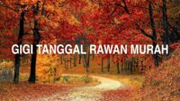 Gigi Tanggal Rawan Murah