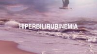 Hiperbilirubinemia