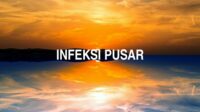Infeksi Pusar