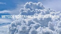 Metode Kontrasepsi Dalam Rahim