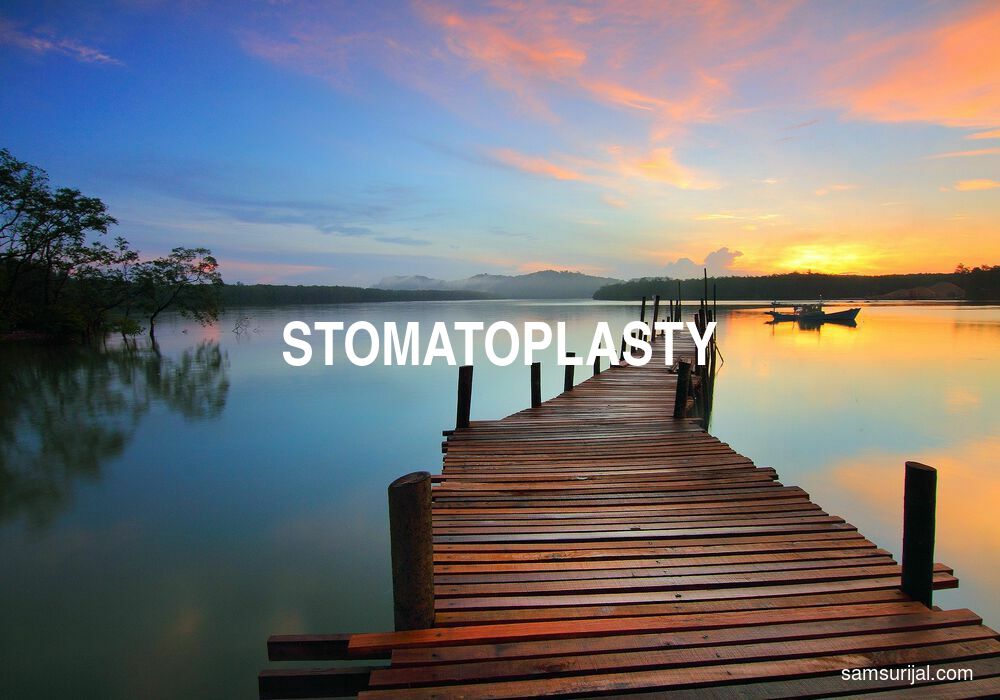 Arti Stomatoplasty